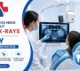 Everything You Need to Know About Dental X Rays and Safety  90x80